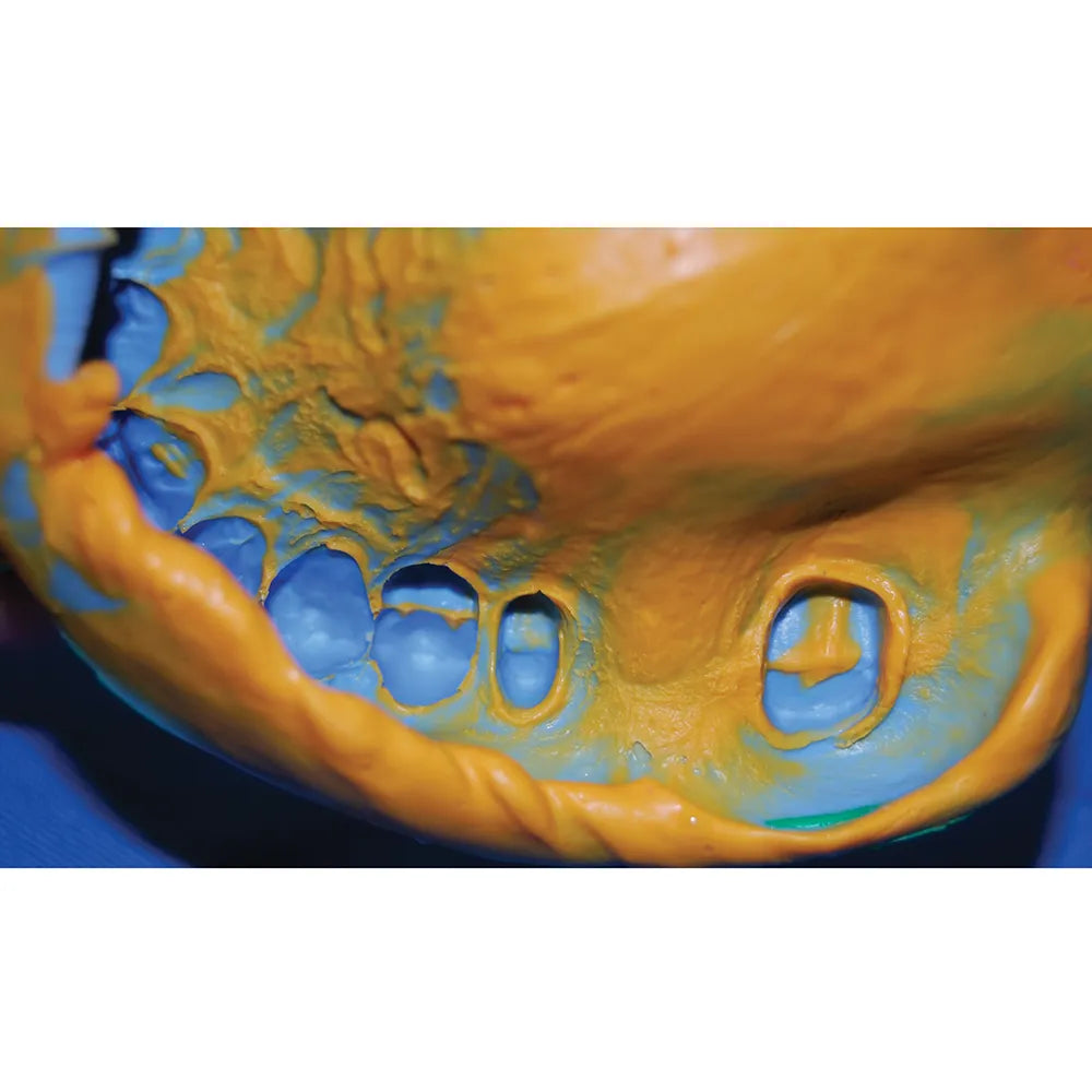 GC Flexceed Putty + Light Body Kit (Mini Kit)