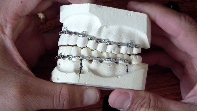 Generic Arch Bar